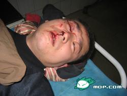 Wang's son was seriously wounded and left lying in the hospital without treatment. (Photo provided by interviewee) Wang's son was seriously wounded and left lying in the hospital without treatment. (Photo provided by interviewee)