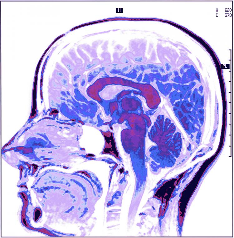 Like a CAT scan, Mr. Feloni's Like a CAT scan, Mr. Feloni's