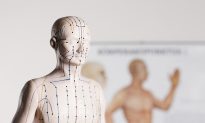 5 Things You Probably Don’t Know About Acupuncture