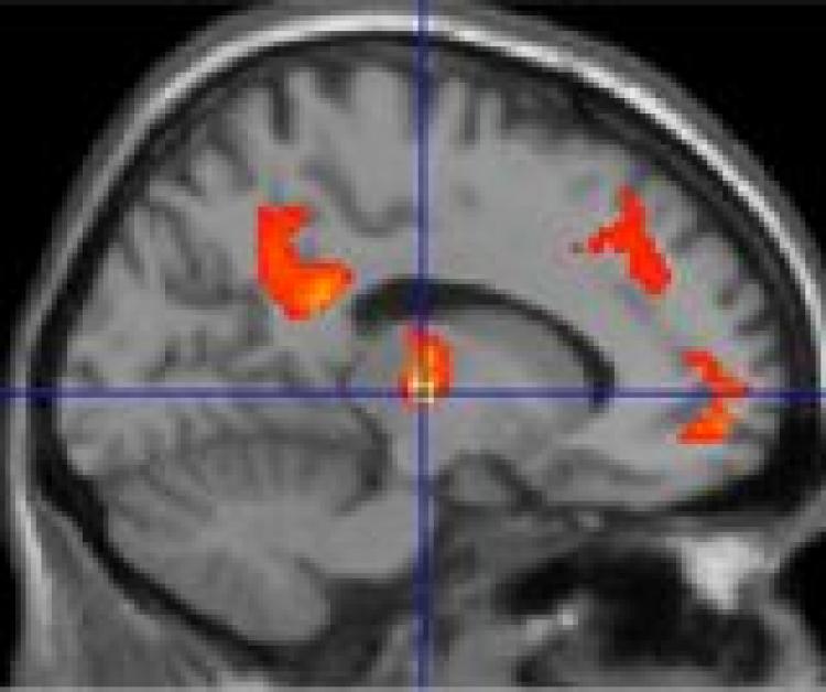 A TRANQUIL BRAIN: Researchers found that tranquil scenes can positively affect the connections between different brain regions. (Michael Hunter/University of Sheffield) A TRANQUIL BRAIN: Researchers found that tranquil scenes can positively affect the connections between different brain regions. (Michael Hunter/University of Sheffield)