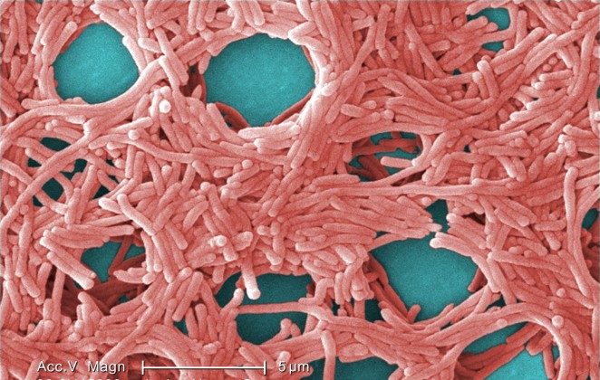 A colorized scanning electron micrograph (SEM) of Legionella pneumophila bacteria. (Janice Haney Carr/CDC/Public Domain)