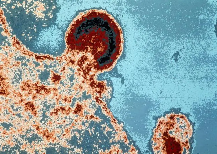 A microscopic view of the HIV virus on a lymphocyte, as seen in a file photo. (AFP/Getty Images)