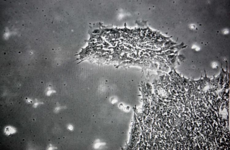 A colony of human embryonic stem cells is seen on a computer monitor that is hooked up to a microscope. (Darren Hauck/Getty Images) A colony of human embryonic stem cells is seen on a computer monitor that is hooked up to a microscope. (Darren Hauck/Getty Images)