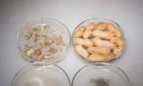 Food Allergies Associated With Reduced COVID-19 Infection