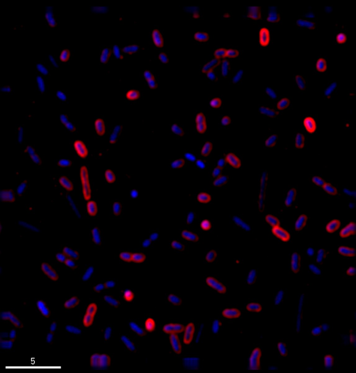 Microscopic image showing newly discovered bacterial strain HS, with stains used to color cell walls red and the DNA or genetic material blue. (Adam Clayton/University of Utah)