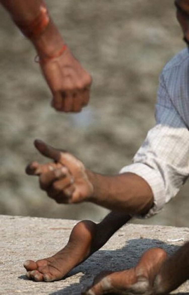 A disabled beggar begs for alms. (Sajjad Hussain/AFP/Getty Images) A disabled beggar begs for alms. (Sajjad Hussain/AFP/Getty Images)