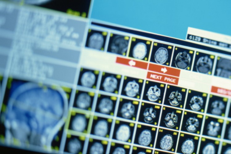 The researchers combined functional Magnetic Resonance Imaging (fMRI) with computer modeling to reconstruct movie trailers that people had previously viewed. (Photos.com) The researchers combined functional Magnetic Resonance Imaging (fMRI) with computer modeling to reconstruct movie trailers that people had previously viewed. (Photos.com)