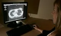 4 Types of Cancer Will Account for Almost Half of New Canadian Cases This Year: Study