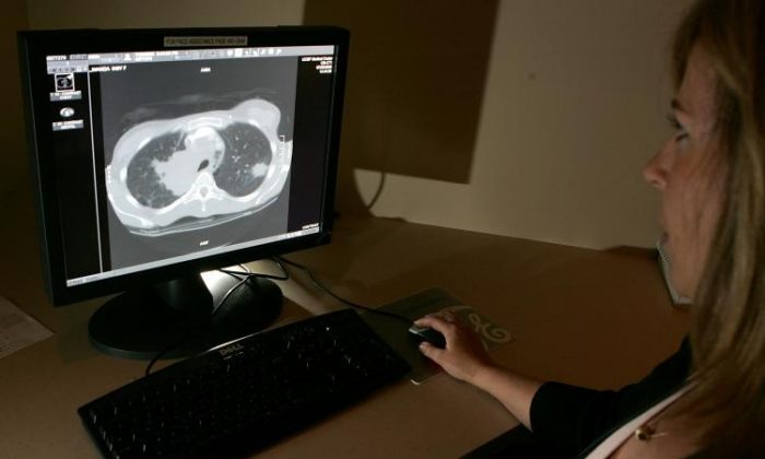 Cancer Screenings Cost Americans $43 Billion Annually