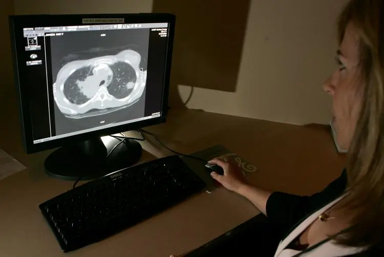 A health-care worker looks at images during a lung cancer screening test that utilizes a type of computed tomography scan, in a file photo. (Justin Sullivan/Getty Images)