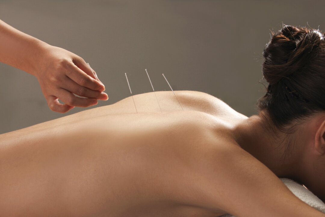 Acupuncture was found effective for reducing pain associated with osteoarthritis, chronic headache, shoulder pain, nonspecific musculoskeletal pain, neck pain and back pain. (Courtesy of Integrative Healing Arts Acupuncture)