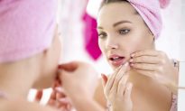 7 Natural Remedies for Teen Acne