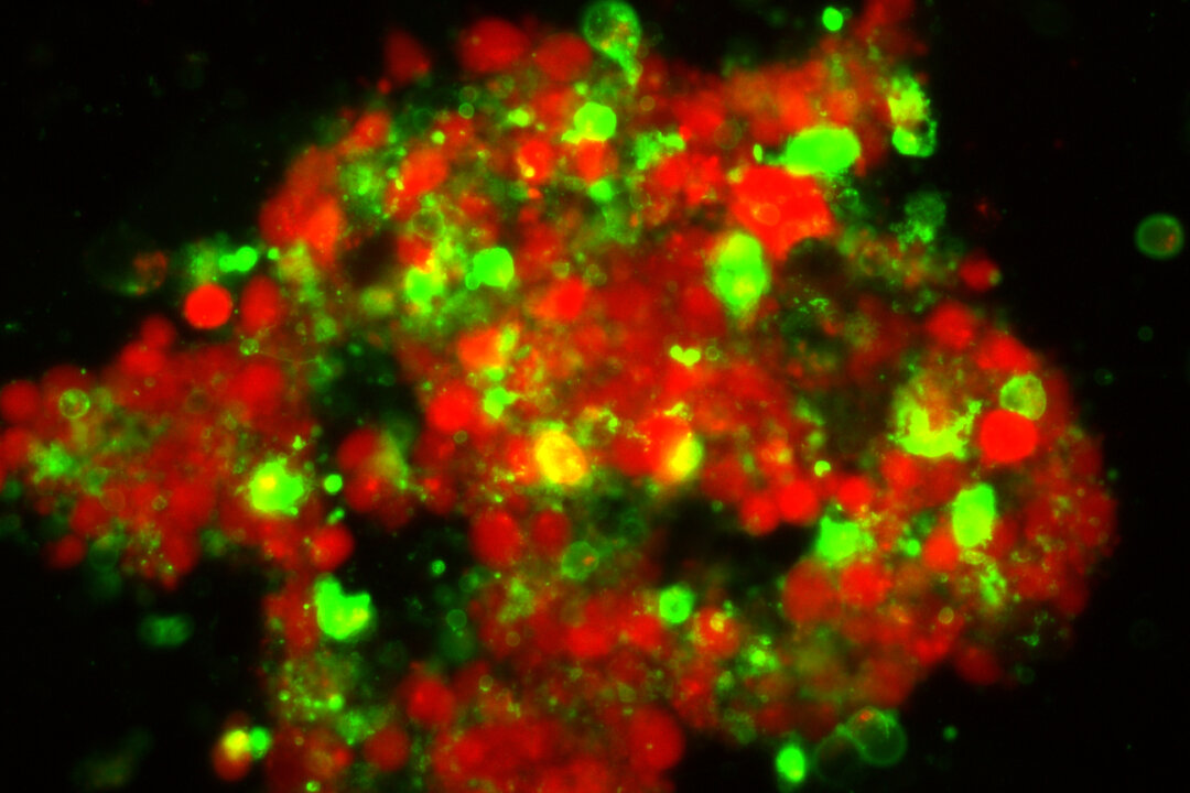 Above, the colon cancer cells in red are unharmed. The ones in green are undergoing a highly orchestrated form of cellular death called “apoptosis.” (Credit: Virginia del Solar)