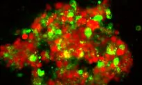 Mysterious Lipids Increase as Cancer Cells Die