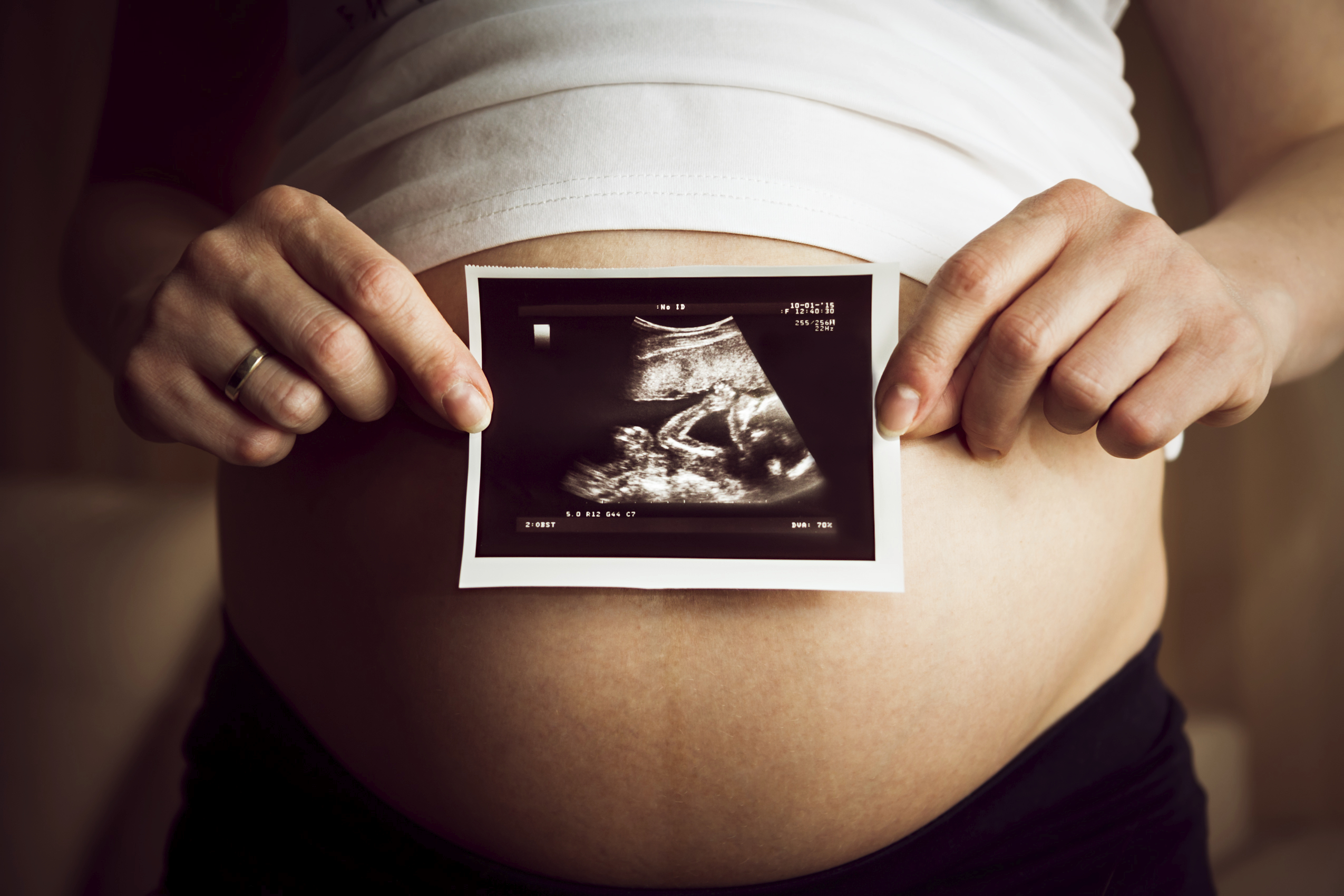 Доверие узи. УЗИ беременной женщины снимок. Ребёнок в животе у мамы.