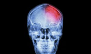 What Makes Us Conscious?