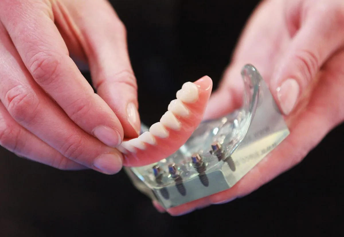 Magnetic false teeth are shown during a trade fair in Hamburg, Germany, on May 3, 2012. (Joern Pollex/Getty Images)