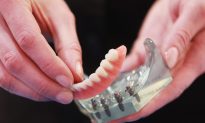 In China, Dentures Are Made with Scrap Steel