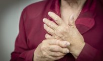 Rheumatoid Arthritis Triggered by Hormone Imbalance in Women