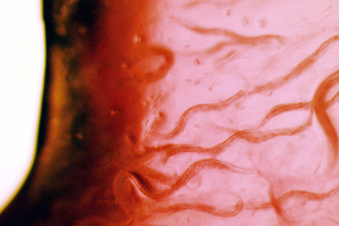 C. elegans nemotodes, or round worms (Volker Kern/NASA/Getty Images)