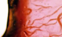 Top 4 Ways You Could Get a Parasite Infection