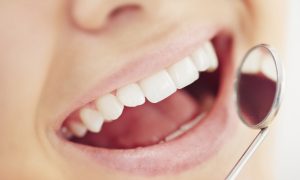 Is Hydrogen Peroxide Mouthwash Harmful for Teeth?