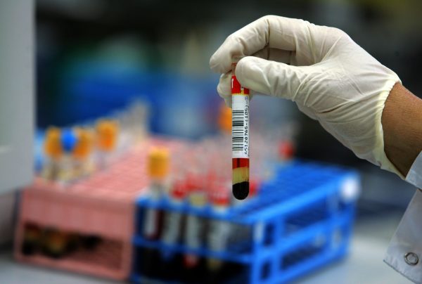Cancer Society Says Blood Testing an Option for Colon, Rectal Cancer