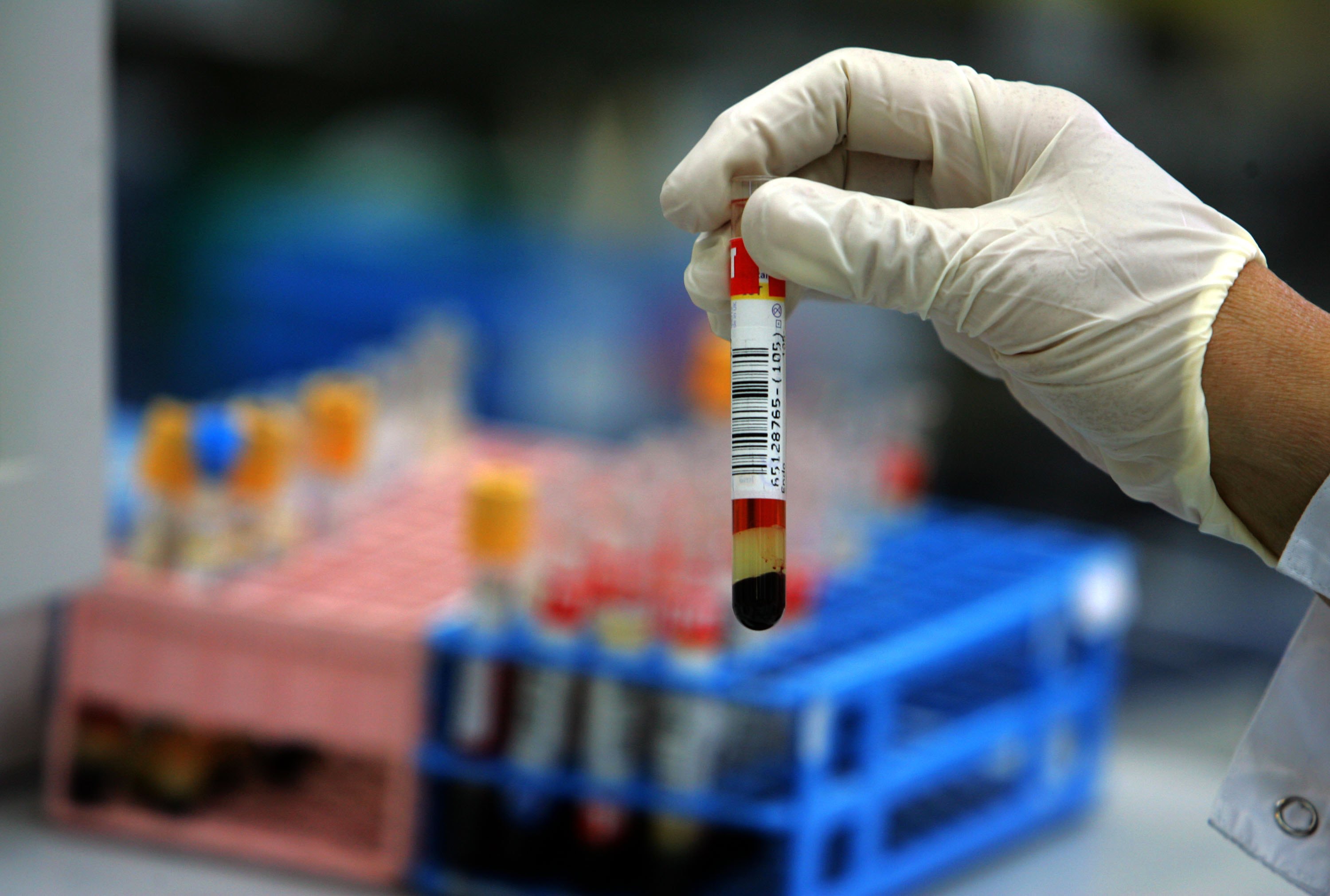 Another Tick Bacteria Turns up in New England Blood Samples - Vimarsana News