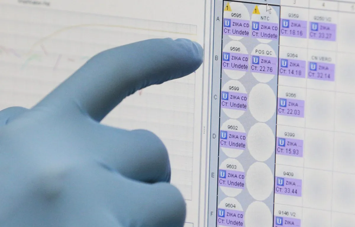 In this Thursday, Feb. 4, 2016, file photo, a medical researcher uses a monitor that shows the results of blood tests for various diseases, including Zika, at the Gorgas Memorial laboratory in Panama City. (AP Photo/Arnulfo Franco)