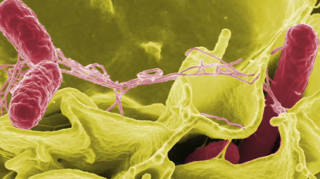 Study Finds Link Between Alzheimer’s Disease And Infections (Video)