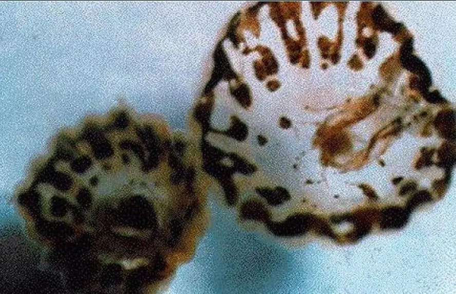 Sea lice (Florida Department of Health)
