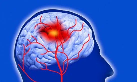 Did a Mexican Teen Actually Die From a Stroke Caused by a Hickey?
