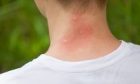 What You Need to Know About Insect Repellent