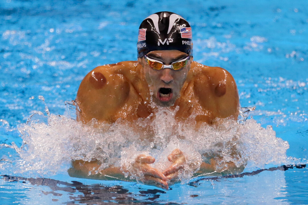 Michael Phelps of the United States competes in the second Semifinal of the Men's 200m Individual Medley on Day 5 of the Rio 2016 Olympic Games at the Olympic Aquatics Stadium in Rio de Janeiro, Brazil, on Aug. 10, 2016. On Phelps’ shoulders can be seen the bruises left by cupping therapy. (Jamie Squire/Getty Images)