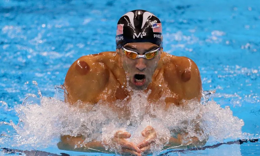 Michael Phelps of the United States competes in the second Semifinal of the Men's 200m Individual Medley on Day 5 of the Rio 2016 Olympic Games at the Olympic Aquatics Stadium in Rio de Janeiro, Brazil, on Aug. 10, 2016. On Phelps’ shoulders can be seen the bruises left by cupping therapy. (Jamie Squire/Getty Images)