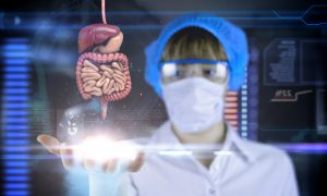 The Fungal Etiology of Inflammatory Bowel Disease