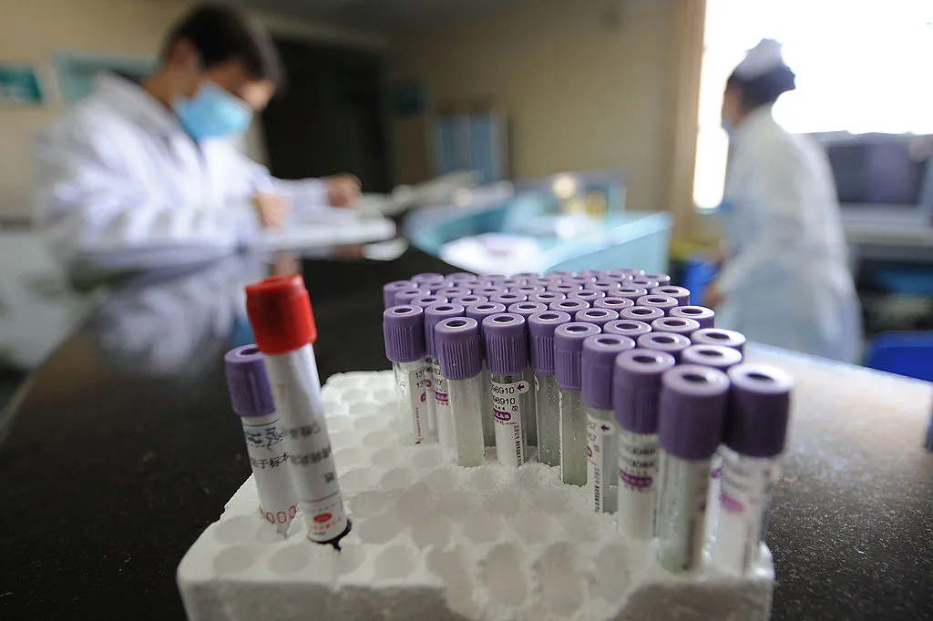 Chinese medical personnel prepare swine flu medicine at a hospital in Hefei in eastern China's Anhui Province on Nov. 25, 2009. (STR/AFP/Getty Images)