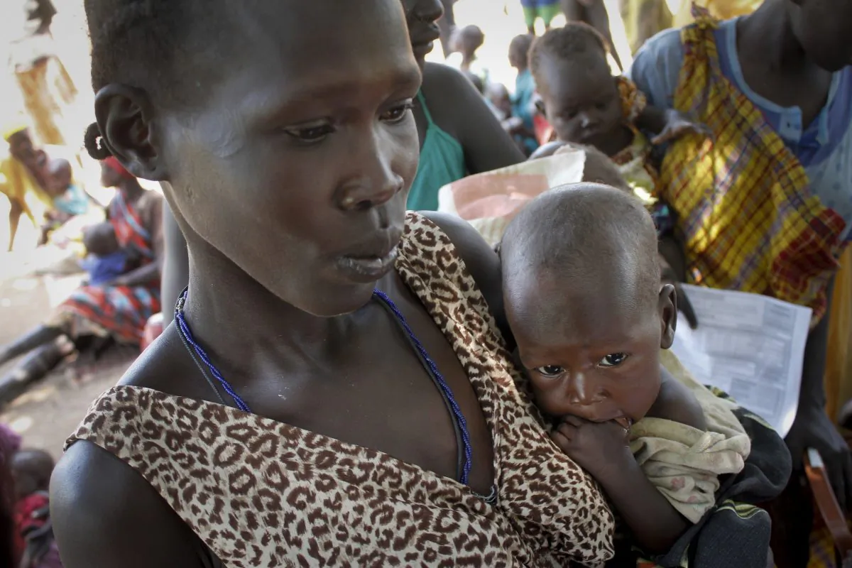 Elizabeth Athiel holds her 8-month-old malnourished daughter Anger, at a UNICEF feeding center in Aweil, South Sudan, where she faced the anguished decision of getting urgent medical attention for Anger at a medical clinic a half-day's walk away, or making sure her other five children could eat at the center where she was, on Sept. 16, 2016. (AP Photo/Justin Lynch)