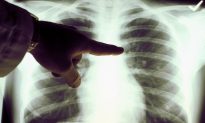 Your Lung Function Is an Important Predictor of Health and Longevity
