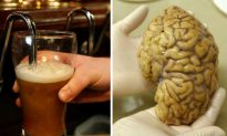 Even Moderate Drinking Linked to Changes in Brain Structure, Study Says