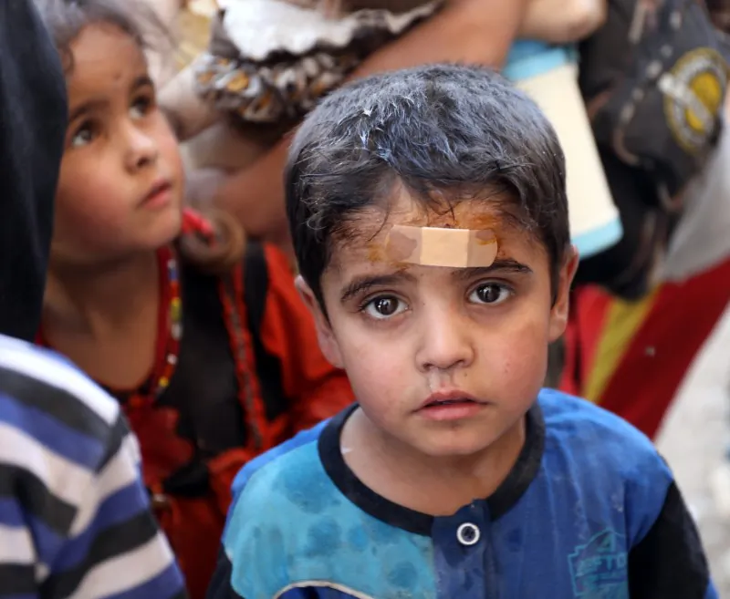 An injured displaced Iraqi child is seen after escaping from Mosul's Old City during fighting between Iraqi security forces and Islamic State militants in Mosul, Iraq June 24 2017. (Reuters/Marius Bosch)
