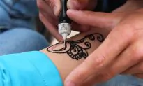 Woman’s Tattoos Are Mistaken for Cancer During PET/CT Scan