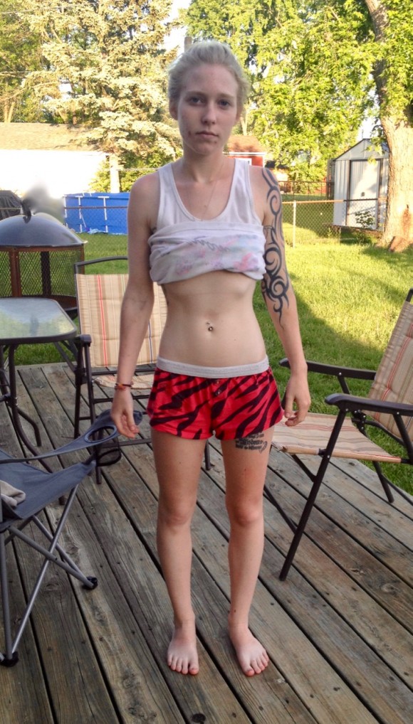 April Erion's "before" photo, taken in her backyard in Ohio at the point when she decided she wanted help for her addiction, on May 25, 2014. (Courtesy of Lori Erion)