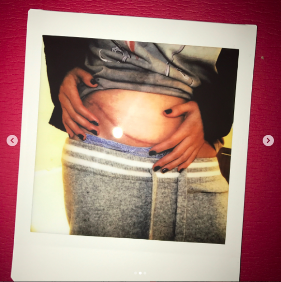 Selena Gomez posted this picture Sept. 14, 2017 after undergoing kidney transplant surgery. (Instagram/Selena Gomez)