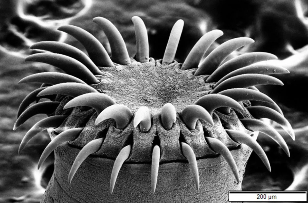 An electron microscope image of a tapeworm's head. ("Tapeworm SEM" by Mogana Das Murtey and Patchamuthu Ramasamy [CC BY-SA 3.0 (ept.ms/2Bw5evC)])