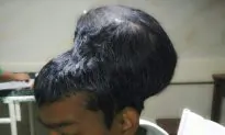 Indian Surgeons Remove ‘Heaviest Recorded’ Brain Tumor