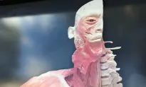 Truckloads of Real Human Corpses and Body Parts On Display in Sydney