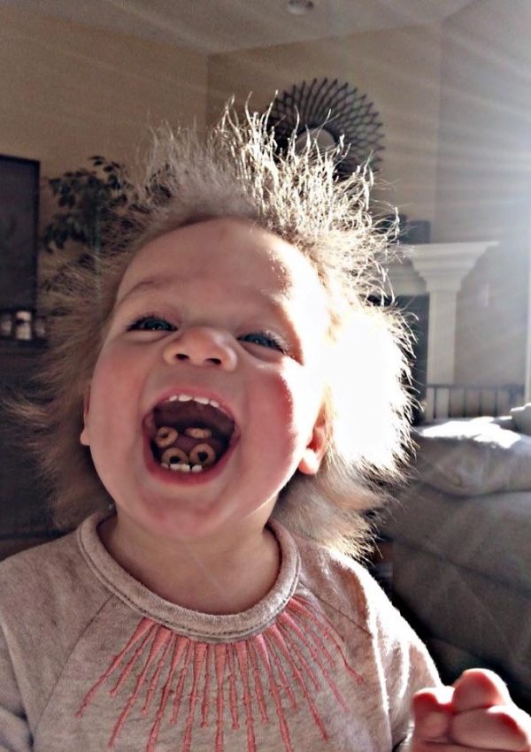 Adorable Toddler Has Uncombable Hair Syndrome and Is Nicknamed 'Einstein 2'  by Her Parents
