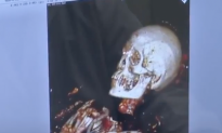 Scientists Scan This 4000-Year-Old Mummy—They are Shocked To Discover How He Died
