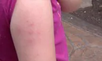 Mosquito Bite Dos and Don’ts